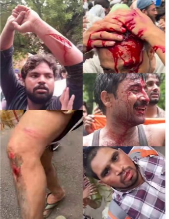 सरकार और उसके सारे तंत्र के ही नहीं, खुद इस मार्च का आह्वान करने वालों के भी सारे अनुमानों को पीछे छोड़ते हुए, लाखों की संख्या में छात्र, युवा और अन्य जनतंत्र की परवाह करने वाले सुबह से ही इस संसद मार्च में शामिल होने के लिए जंतर-मंतर की तथा संसद की ओर जाने वाले सभी रास्तों पर जमा हो गए।